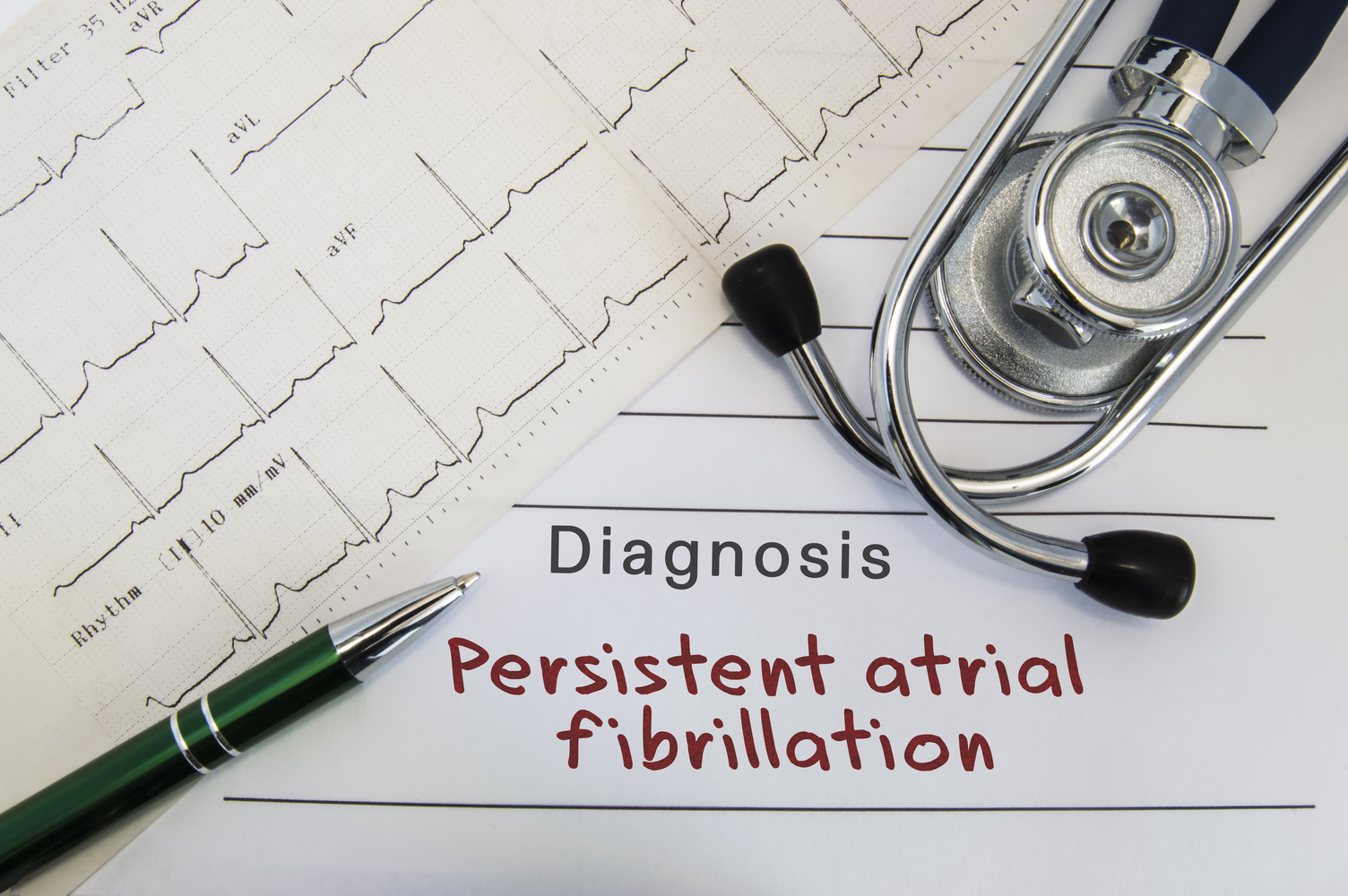 An Overview of Atrial Fibrillation