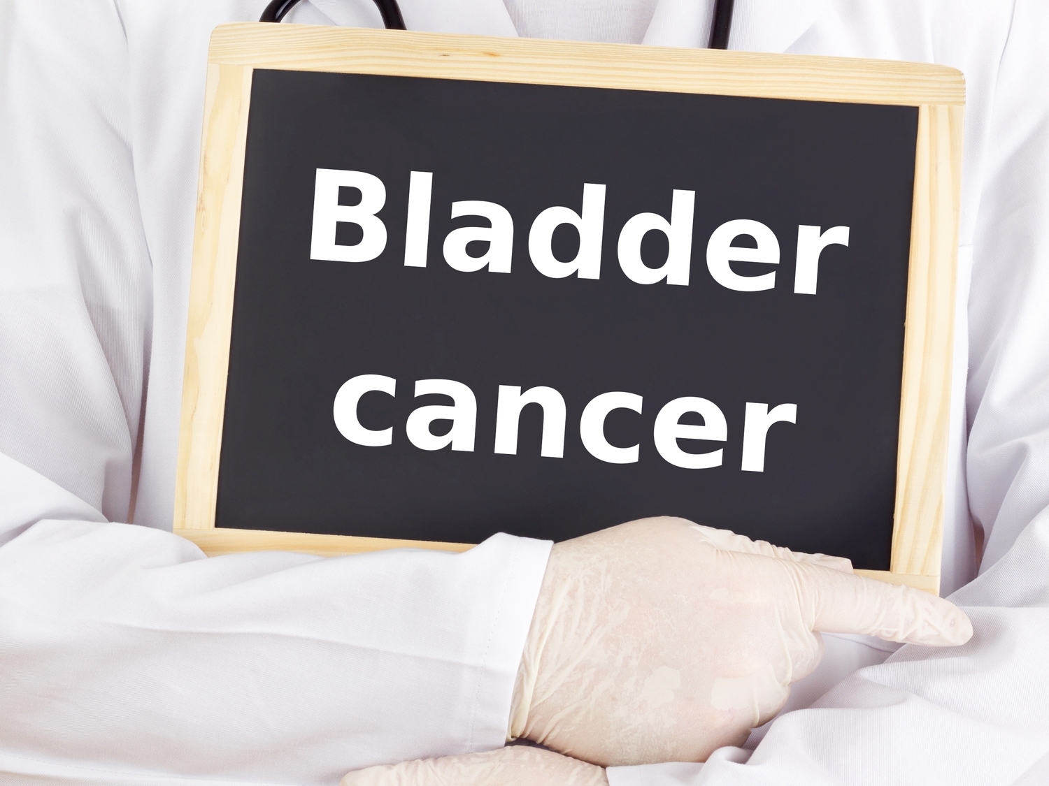 Bladder Cancer: Stages and Treatments